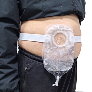 Urostomy Bag