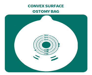 Convex Chassis Ostomy Bag