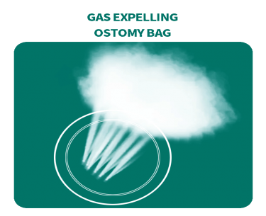 Exhaust Washable Ostomy Bag