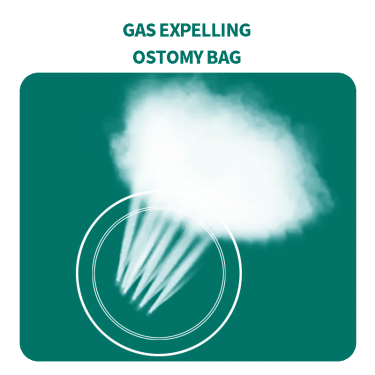 可排气冲洗造口袋